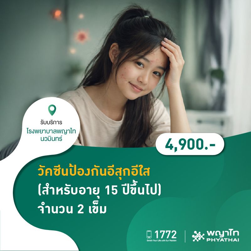 (โรงพยาบาลพญาไท นวมินทร์) วัคซีนป้องกันอีสุกอีใส จำนวน 2 เข็ม (สำหรับอายุ 15 ปีขึ้นไป) MKZ2766