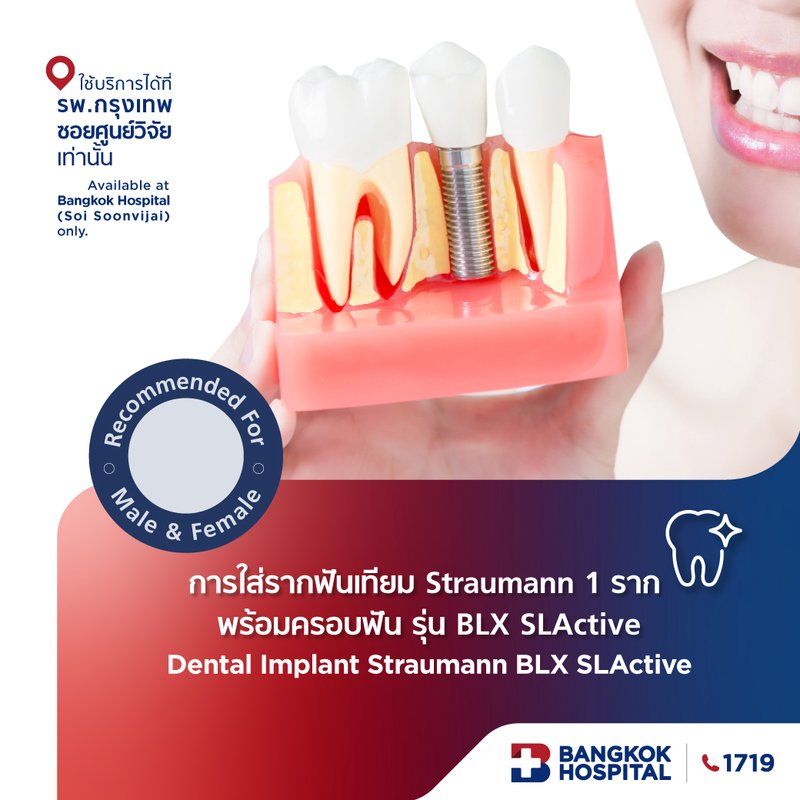 การใส่รากฟันเทียม Straumann 1 ราก พร้อมครอบฟัน รุ่น Roxolid BLX SLActive