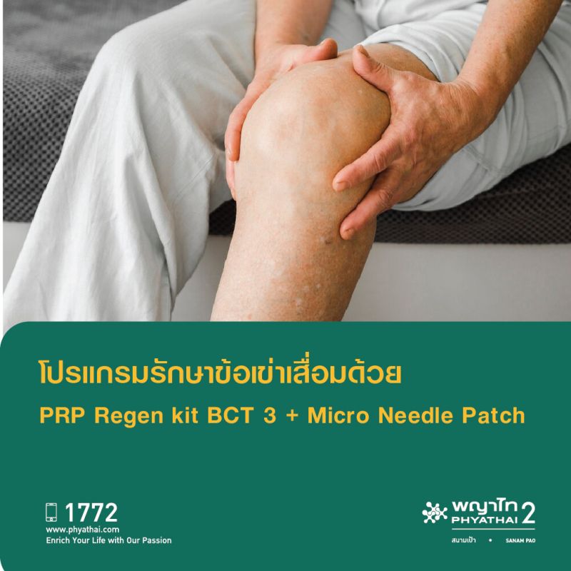 (พญาไท 2) โปรแกรมรักษาข้อเข่าเสื่อมด้วย PRP Regen kit BCT 3 + Micro needle pacth