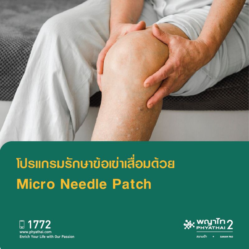 (พญาไท 2) โปรแกรมการรักษาข้อเข่าเสื่อมด้วย Micro Needle patch